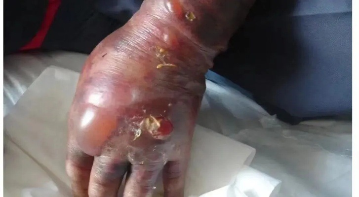 大秘境词缀死疽到底有多可怕？